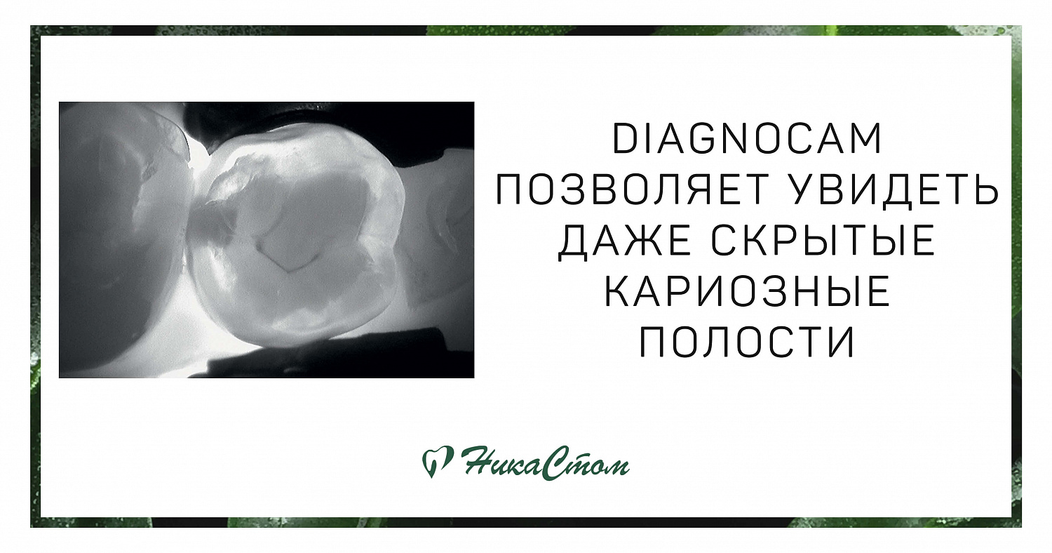 Диагностика прибором DIAGNOcam